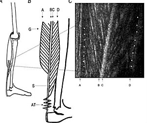 Schematic drawings of the gastrocnemius muscle